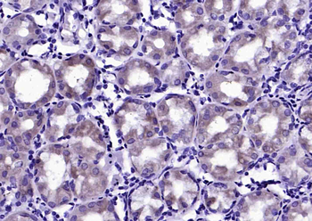 Phospho-SHC1 (Ser36) Rabbit Polyclonal Antibody