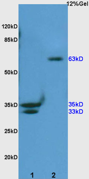 Phospho-SHC1 (Ser36) Rabbit Polyclonal Antibody