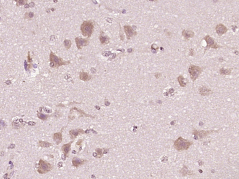 Phospho-SHC1 (Tyr427) Rabbit Polyclonal Antibody