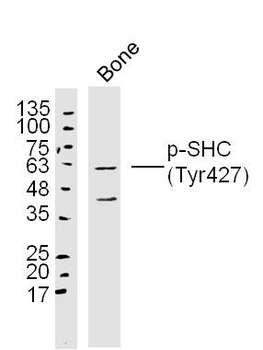 Phospho-SHC1 (Tyr427) Rabbit Polyclonal Antibody