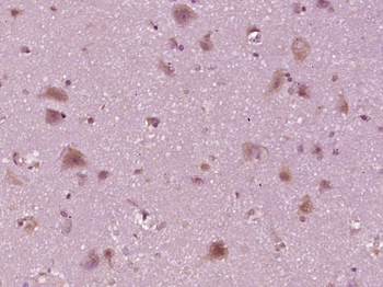 Phospho-SHC1 (Tyr317) Rabbit Polyclonal Antibody