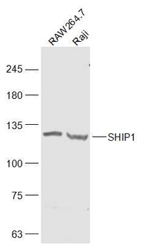 SHIP1 Rabbit Polyclonal Antibody