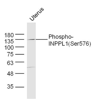 Phospho-INPPL1 (Ser576) Rabbit Polyclonal Antibody