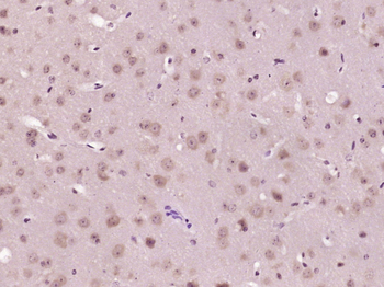 Phospho-PTPN11 (Tyr542) Rabbit Polyclonal Antibody