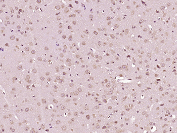 Phospho-PTPN11 (Tyr580) Rabbit Polyclonal Antibody