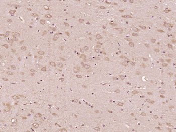 Phospho-PTPN11 (Tyr580) Rabbit Polyclonal Antibody