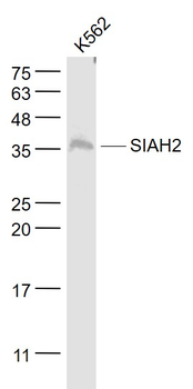 SIAH2 Rabbit Polyclonal Antibody
