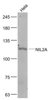 ZEB1/NIL2A Rabbit Polyclonal Antibody