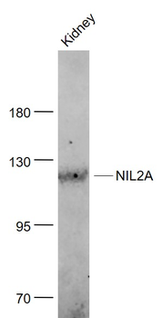 ZEB1/NIL2A Rabbit Polyclonal Antibody