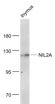 ZEB1/NIL2A Rabbit Polyclonal Antibody