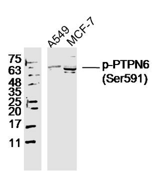 Phospho-PTPN6 (Ser591) Rabbit Polyclonal Antibody