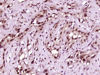 Phospho-SIRT6 (Ser338) Rabbit Polyclonal Antibody