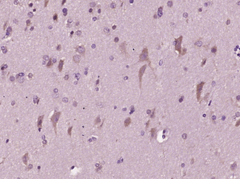 MCT4/SLC16A3 Rabbit Polyclonal Antibody