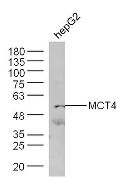MCT4/SLC16A3 Rabbit Polyclonal Antibody