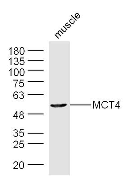 MCT4/SLC16A3 Rabbit Polyclonal Antibody