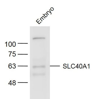 SLC40A1 Rabbit Polyclonal Antibody
