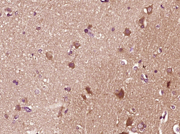 Phospho-Smad1 (Ser206) Rabbit Polyclonal Antibody