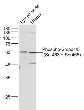 Phospho-Smad1/5 (Ser463 + Ser465) Rabbit Polyclonal Antibody