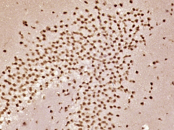 Phospho-Smad1/5 (Ser463 + Ser465) Rabbit Polyclonal Antibody