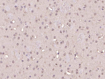 Phospho-Smad1/5 (Ser463 + Ser465) Rabbit Polyclonal Antibody