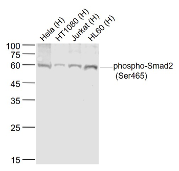 Phospho-Smad2 (Ser465) Rabbit Polyclonal Antibody