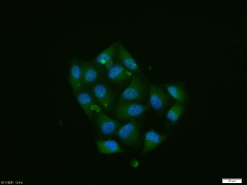 Phospho-Smad2 (Ser465 + Ser467) Rabbit Polyclonal Antibody