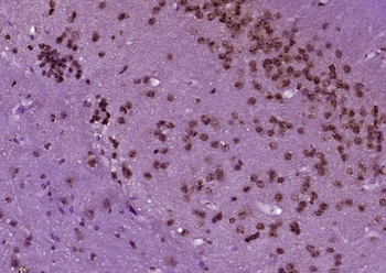 Phospho-Smad2 (Ser465 + Ser467) Rabbit Polyclonal Antibody