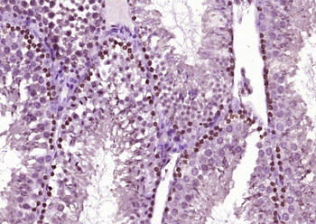 Phospho-Smad2 (Ser465 + Ser467) Rabbit Polyclonal Antibody