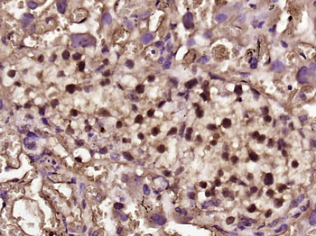 Phospho-Smad2 (Ser245 + Ser250 + Ser255) Rabbit Polyclonal Antibody