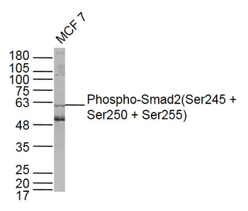 Phospho-Smad2 (Ser245 + Ser250 + Ser255) Rabbit Polyclonal Antibody