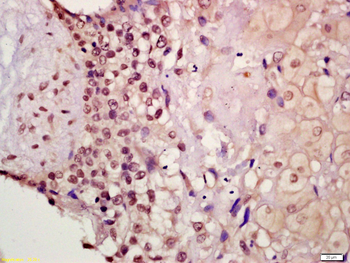 Phospho-Smad2 (Thr220) Rabbit Polyclonal Antibody