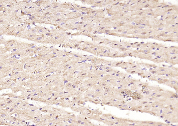 Phospho-Smad3 (Ser423 + Ser425) Rabbit Polyclonal Antibody