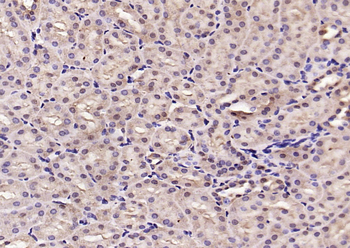 Phospho-Smad3 (Ser423 + Ser425) Rabbit Polyclonal Antibody
