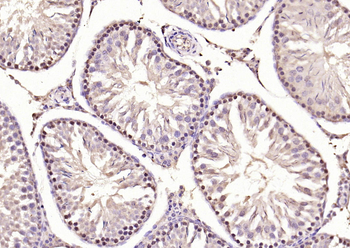 Phospho-Smad3 (Ser423 + Ser425) Rabbit Polyclonal Antibody