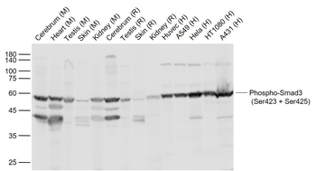 Phospho-Smad3 (Ser423 + Ser425) Rabbit Polyclonal Antibody