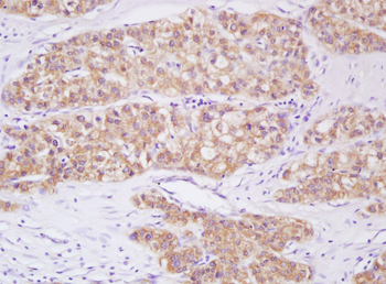 Phospho-Smad3 (Ser423 + Ser425) Rabbit Polyclonal Antibody