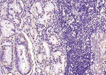 Phospho-Smad3 (Ser423 + Ser425) Rabbit Polyclonal Antibody