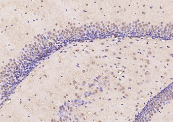 Phospho-Smad3 (Ser423 + Ser425) Rabbit Polyclonal Antibody
