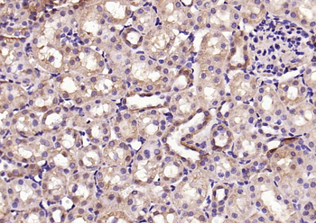 Phospho-Smad3 (Ser423 + Ser425) Rabbit Polyclonal Antibody
