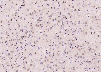 Phospho-Smad3 (Ser423 + Ser425) Rabbit Polyclonal Antibody