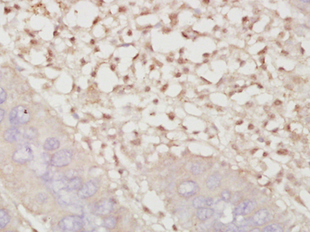 Phospho-Smad3 (Ser425) Rabbit Polyclonal Antibody