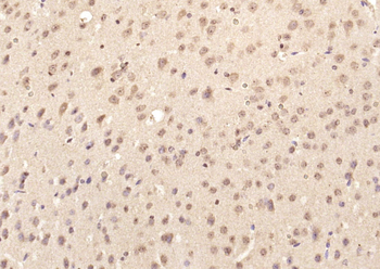 Phospho-Smad3 (Ser425) Rabbit Polyclonal Antibody