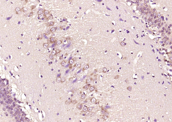 Phospho-Smad3 (Ser425) Rabbit Polyclonal Antibody