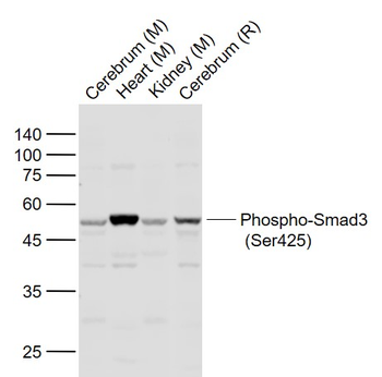 Phospho-Smad3 (Ser425) Rabbit Polyclonal Antibody