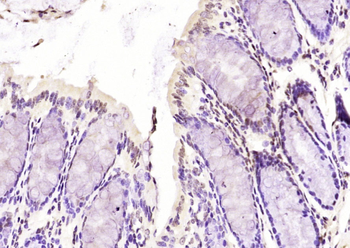 Phospho-SMC1 (Ser360) Rabbit Polyclonal Antibody