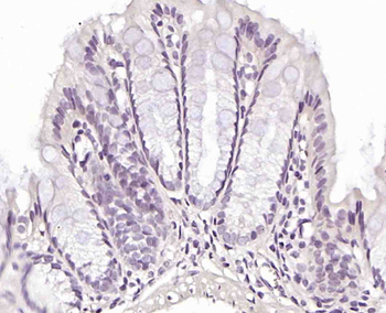 Phospho-SMC1 (Ser360) Rabbit Polyclonal Antibody
