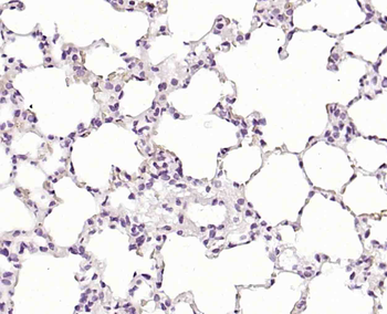 Phospho-SMC1 (Ser360) Rabbit Polyclonal Antibody