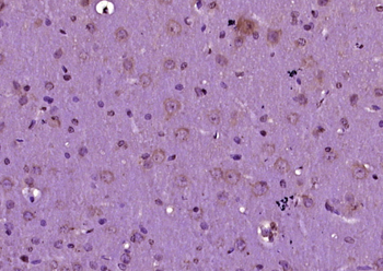 SMAD9 Rabbit Polyclonal Antibody