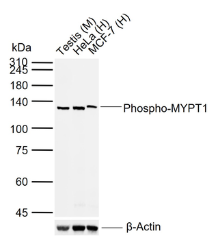 Phospho-MYPT1 (Thr696) Rabbit Polyclonal Antibody