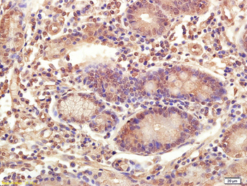 Twist2 Rabbit Polyclonal Antibody